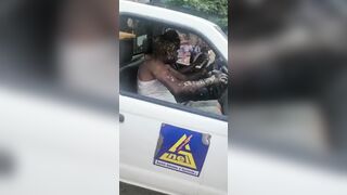 Man Loses most of his Skin in Explosion while Working and NOT being Safe (And Aftermath)