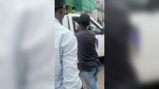 Man Loses most of his Skin in Explosion while Working and NOT being Safe (And Aftermath)