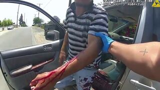 Officer Helping Man with a Tourniquet Ends Up Shooting same Man once he Pulls Knife