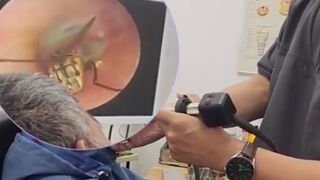 A New Fear: Big Fly Burrowed inside your Ear