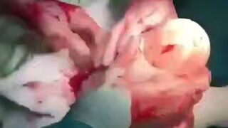 Just STOP putting Things into your Butt! This is SICK HUGE