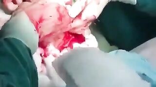 Just STOP putting Things into your Butt! This is SICK HUGE
