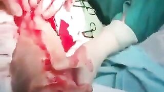 Just STOP putting Things into your Butt! This is SICK HUGE