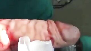 Just STOP putting Things into your Butt! This is SICK HUGE