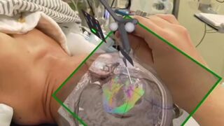 Creepy Amazing New Technology allows Surgeons to See Inside your Brain