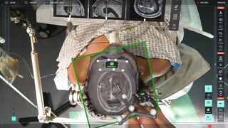 Creepy Amazing New Technology allows Surgeons to See Inside your Brain