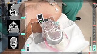 Creepy Amazing New Technology allows Surgeons to See Inside your Brain