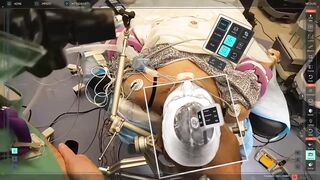 Creepy Amazing New Technology allows Surgeons to See Inside your Brain