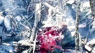 Ukrainian Soldier hit by Drone..You can see his Heart still Beating