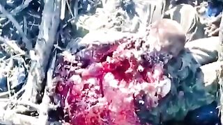 Ukrainian Soldier hit by Drone..You can see his Heart still Beating