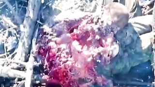 Ukrainian Soldier hit by Drone..You can see his Heart still Beating