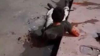 If you had a Knife stuck in your Head...(takes it out at :46)