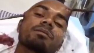 This Guy..Will He Live?