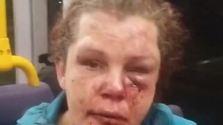 Dublin woman gets the shit kicked out of her by her alcoholic partner