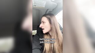 "My $11,000 nose job gave me clarity to ask for a divorce"