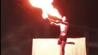 Whoops: 20-Year-Old Suffers Facial Burns After Fire-Breathing Stunt Goes Wrong