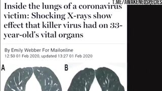 Once you start to notice it, you can't unsee it. Was 33 a Signal for Covid?