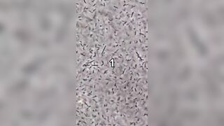 A Drop of Whiskey vs Bacteria! Geez, It's like an Atomic Bomb!!! Wild