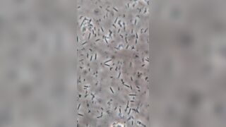 A Drop of Whiskey vs Bacteria! Geez, It's like an Atomic Bomb!!! Wild
