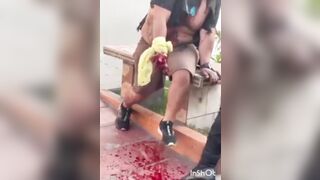 A Peruvian police officer touched a Bag he thought was suspicious
