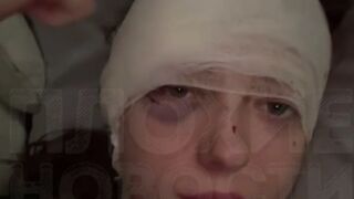 Girl's Face Slashed by Crazy Guy with a Wine Glass b/c She didn't Give Him Attention