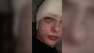 Girl's Face Slashed by Crazy Guy with a Wine Glass b/c She didn't Give Him Attention