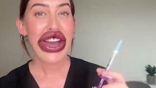 Ladies - what’s stopping you making an appointment to get lips like hers?