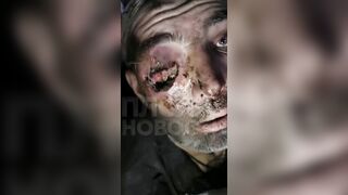 Soldier on the Front with Eye Injury could not get Medic Help for a While