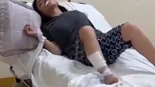 Woman in acute stage of Rabies