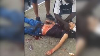 Knife Fight go Wrong