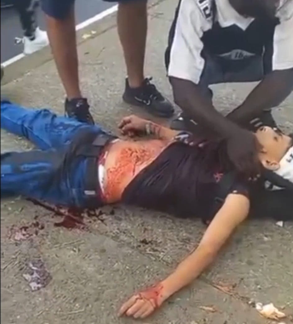 Knife Fight go Wrong