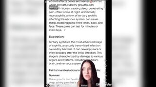 Tertiary Syphilis?