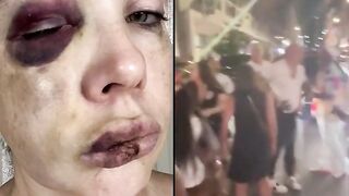 Ohio Senator Releases Horrific Photos Of The White Woman Beaten by Blacks