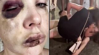 Ohio Senator Releases Horrific Photos Of The White Woman Beaten by Blacks