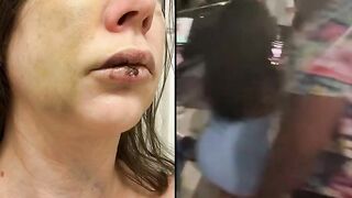 Ohio Senator Releases Horrific Photos Of The White Woman Beaten by Blacks