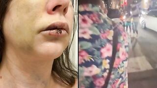 Ohio Senator Releases Horrific Photos Of The White Woman Beaten by Blacks