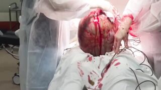 Incredible sized Tumor removed from 19 Year Old Girl (Successfully)