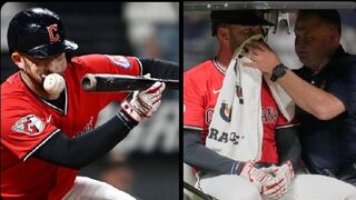 WATCH: MLB player David Fry hit in the face by 99mph pitch Prayers up.