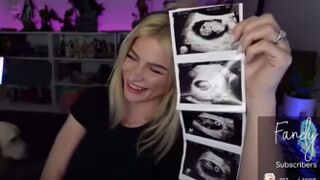 WILD: Twitch Streamer Gives Birth Live in Front 29000 Viewers