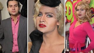 This guy spent $75,000 to look like Madonna! He's had 18 surgeries.