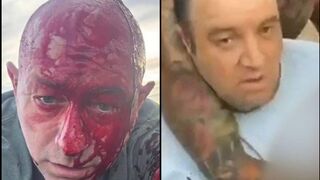 The Bondi Beach Terror Attack Became Israel's Most EMBARRASSING False Flag FLOP yet!