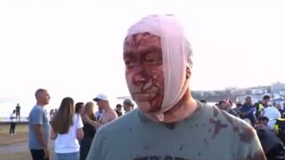 I called it early. So did a few others. It's amazing to see how many are awake!!!